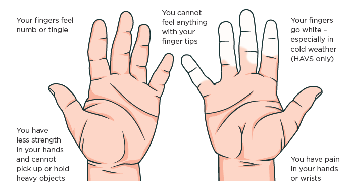 WKS-diagram-hands-vibration.png